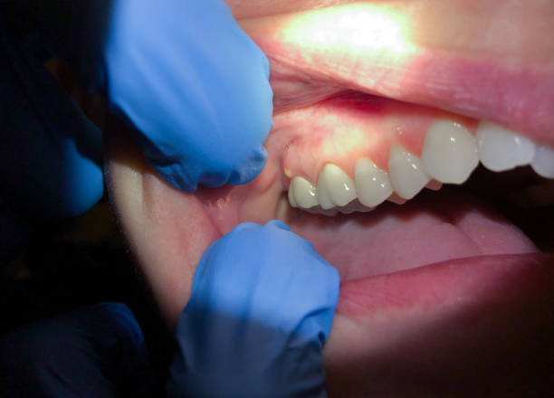 Best Broken or Cracked Tooth Emergency Dentist in Kings Grant, NC