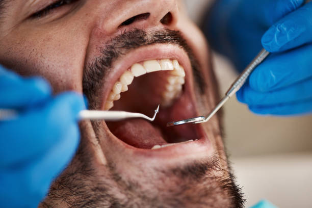 Best Emergency Dentist for Knocked-Out Tooth in Kings Grant, NC
